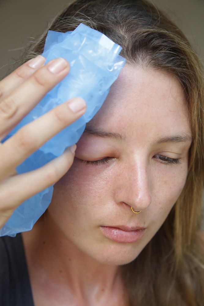 How Do You Treat An Insect Sting While Camping?