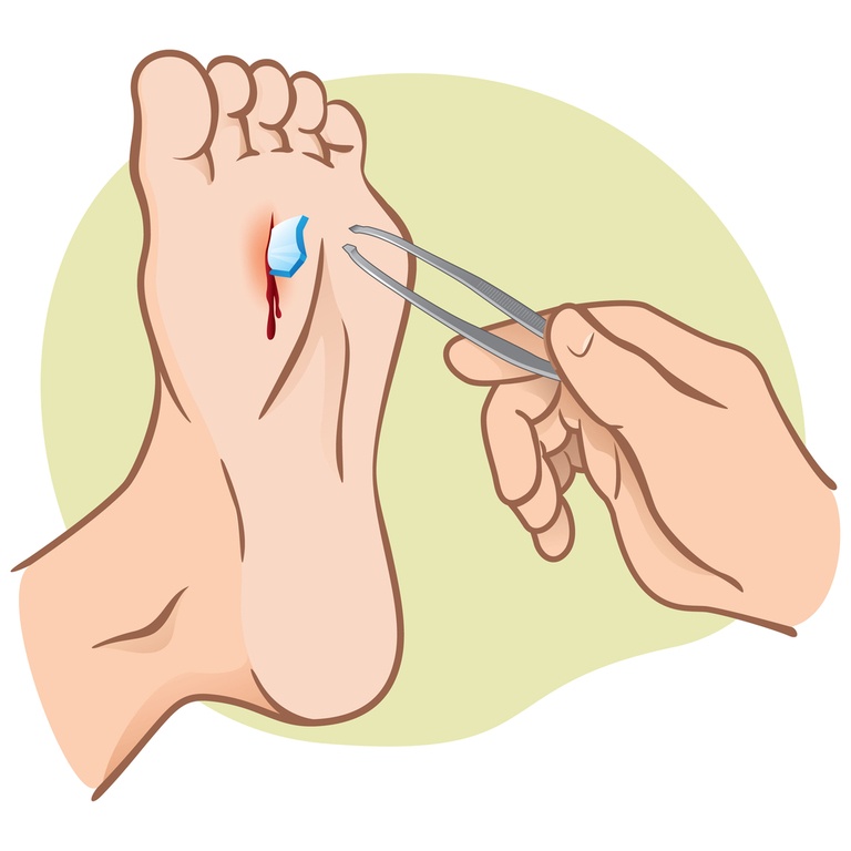 How to Treat Cuts, Scrapes, and Gouges in the Backcountry?
