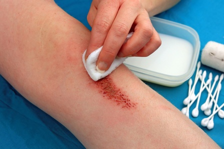 How to Treat Cuts, Scrapes, and Gouges in the Backcountry?